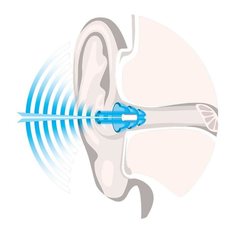 NoNoise Water Sports Noise Filter Hearing Protection
